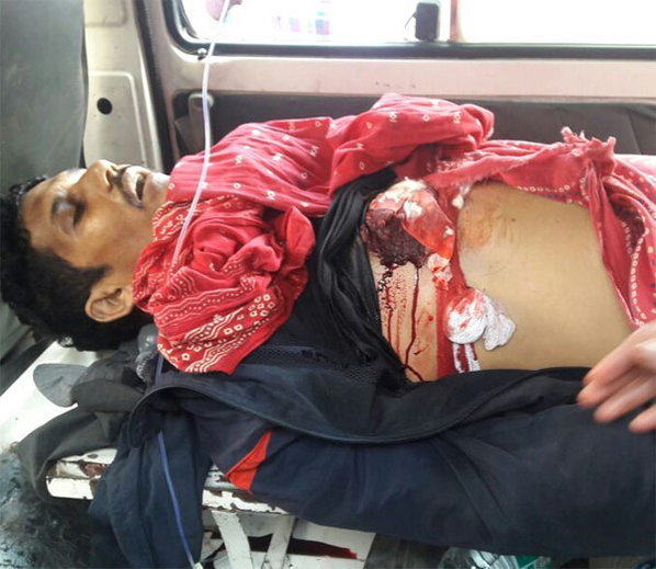 Bihar journalist attack