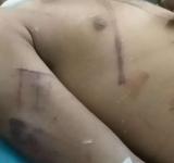Dalit boy killed