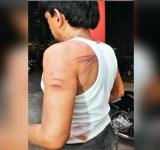 POlice atrocity
