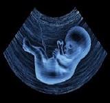 female-fetus 