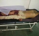 Dalit Killed in Gujarat