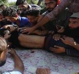 Nasir Shafi Qazi 11 year old Kashmiri Boy Hit by Pellets
