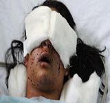 pellet guns injuries