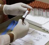 Zika Virus